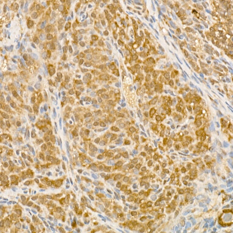 Immunohistochemistry - Anti-CK1 epsilon Antibody (A305708) - Antibodies.com