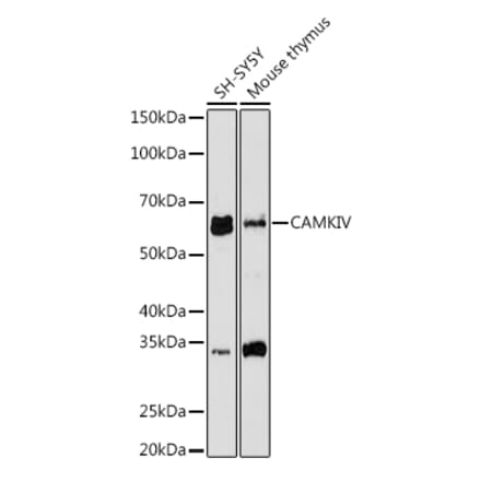 Western Blot - Anti-CAMKIV Antibody [ARC1506] (A305710) - Antibodies.com