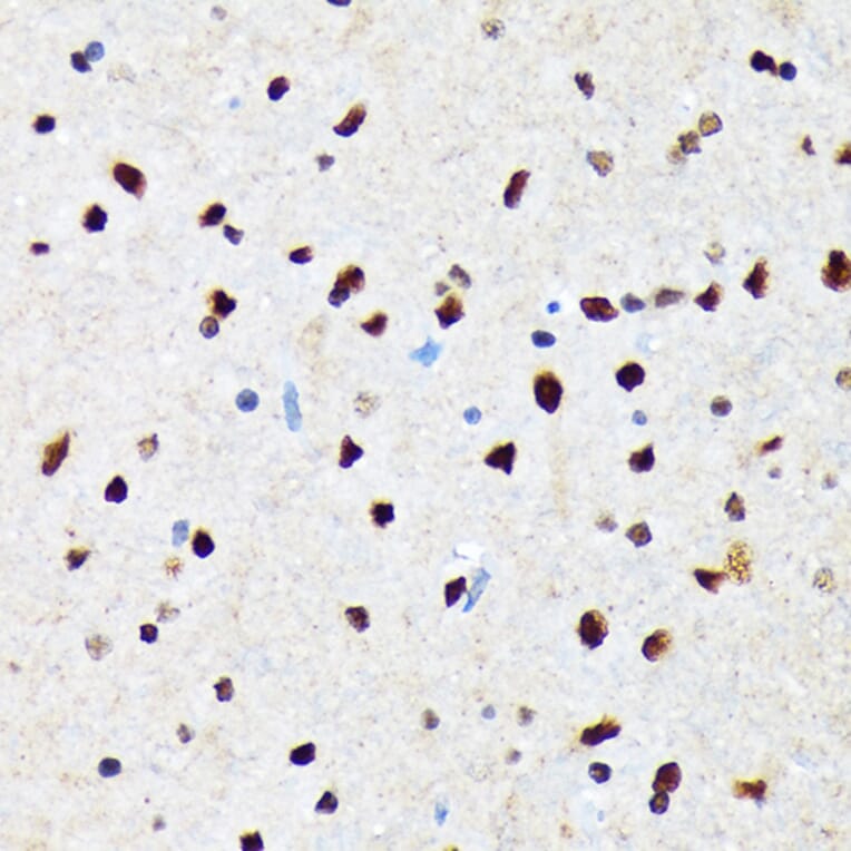 Immunohistochemistry - Anti-CAMKIV Antibody [ARC1506] (A305710) - Antibodies.com