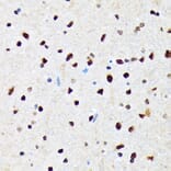 Immunohistochemistry - Anti-CAMKIV Antibody [ARC1506] (A305710) - Antibodies.com