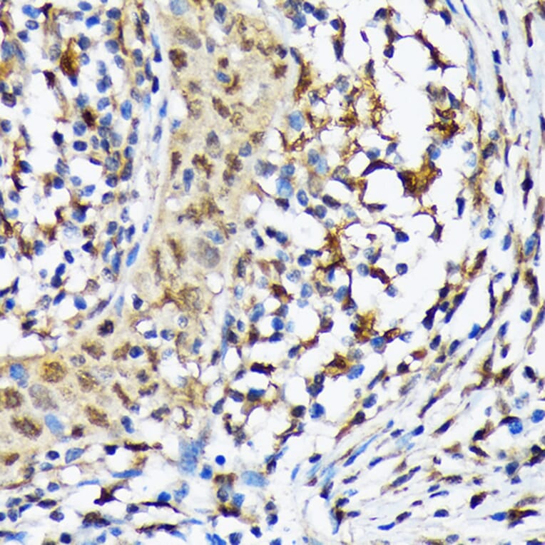 Immunohistochemistry - Anti-CAMKIV Antibody [ARC1506] (A305710) - Antibodies.com