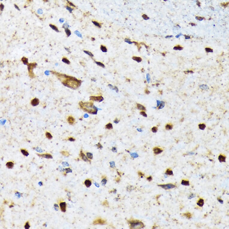 Immunohistochemistry - Anti-CAMKIV Antibody [ARC1506] (A305710) - Antibodies.com