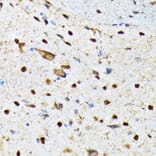 Immunohistochemistry - Anti-CAMKIV Antibody [ARC1506] (A305710) - Antibodies.com