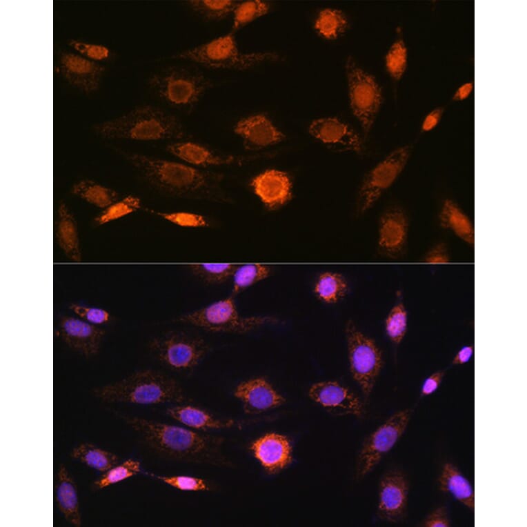 Immunofluorescence - Anti-CAMKIV Antibody [ARC1506] (A305710) - Antibodies.com