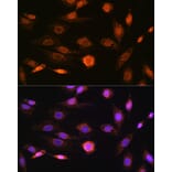 Immunofluorescence - Anti-CAMKIV Antibody [ARC1506] (A305710) - Antibodies.com