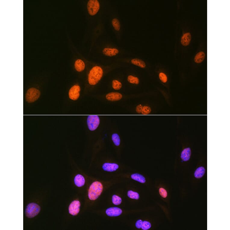 Immunofluorescence - Anti-CAMKIV Antibody [ARC1506] (A305710) - Antibodies.com