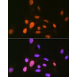 Immunofluorescence - Anti-CAMKIV Antibody [ARC1506] (A305710) - Antibodies.com