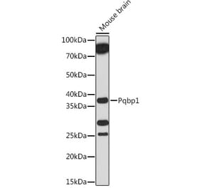 Western Blot - Anti-Pqbp1 Antibody (A305711) - Antibodies.com