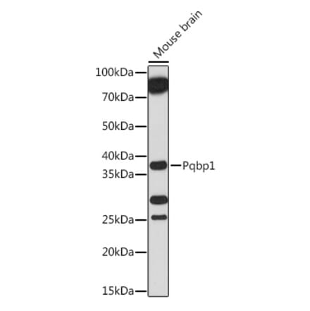Western Blot - Anti-Pqbp1 Antibody (A305711) - Antibodies.com