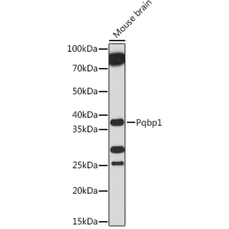 Western Blot - Anti-Pqbp1 Antibody (A305711) - Antibodies.com