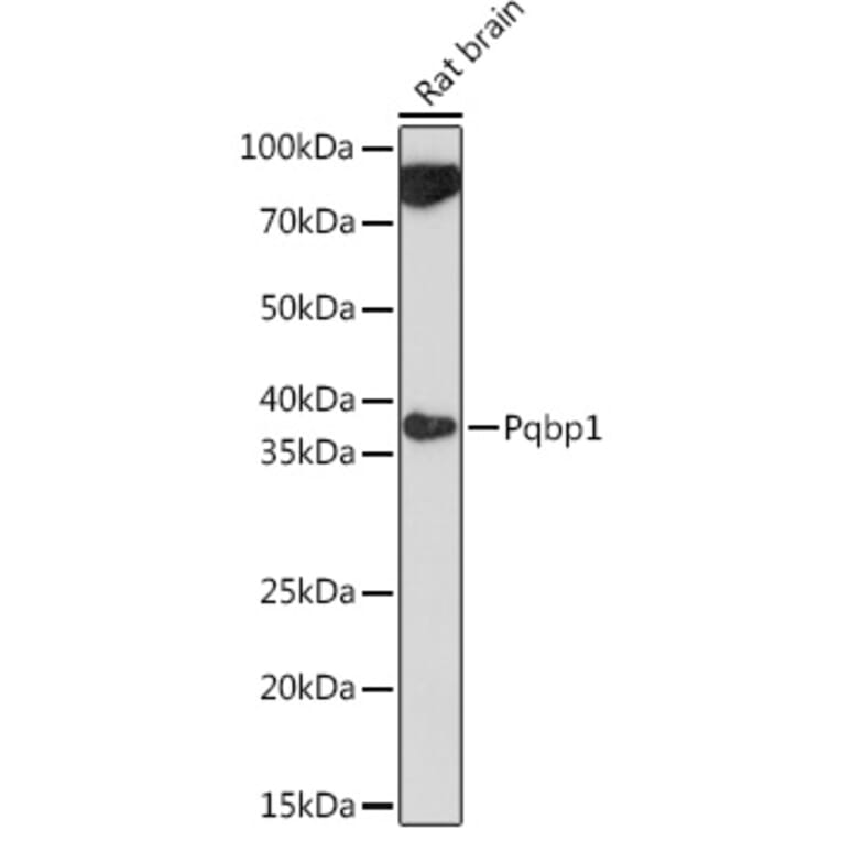 Western Blot - Anti-Pqbp1 Antibody (A305711) - Antibodies.com