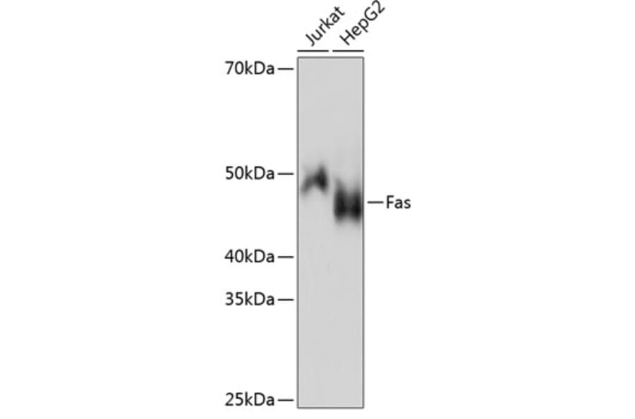 Western Blot - Anti-Fas Antibody [ARC0061] (A305713) - Antibodies.com