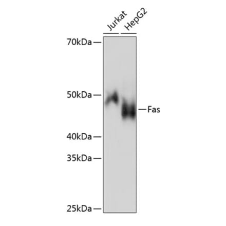 Western Blot - Anti-Fas Antibody [ARC0061] (A305713) - Antibodies.com