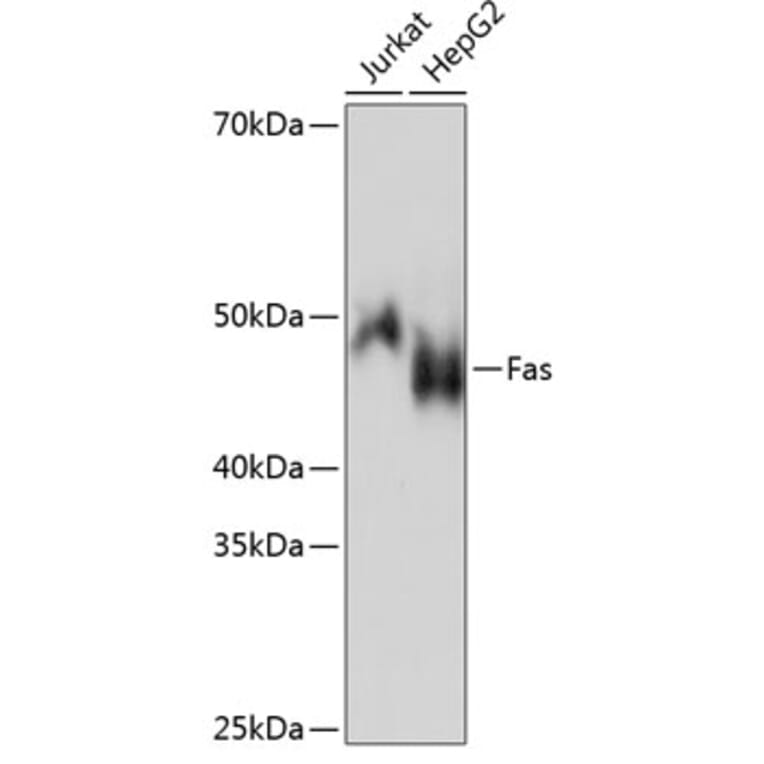 Western Blot - Anti-Fas Antibody [ARC0061] (A305713) - Antibodies.com