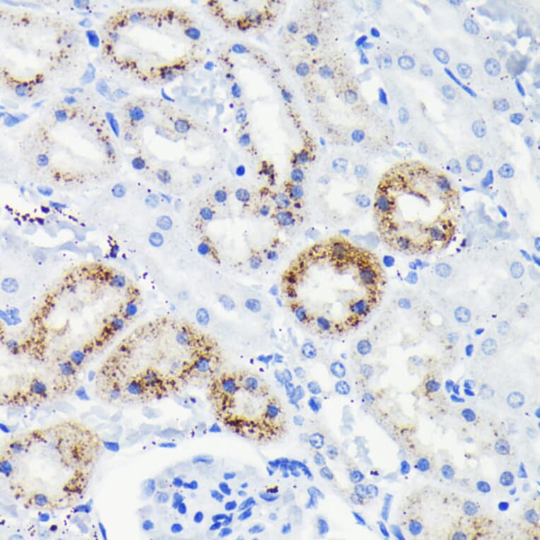 Immunohistochemistry - Anti-Fas Antibody [ARC0061] (A305713) - Antibodies.com