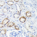 Immunohistochemistry - Anti-Fas Antibody [ARC0061] (A305713) - Antibodies.com