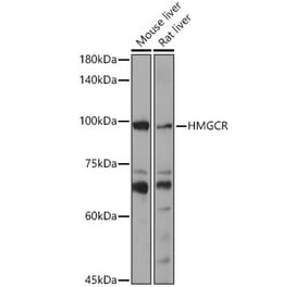 Western Blot - Anti-HMGCR Antibody (A305714) - Antibodies.com
