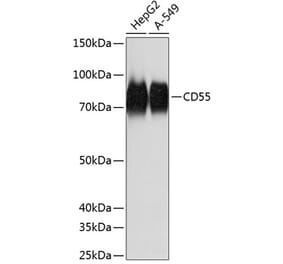 Western Blot - Anti-CD55 Antibody [ARC0568] (A305715) - Antibodies.com