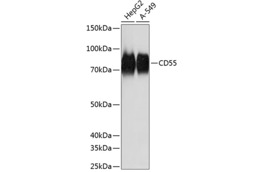 Western Blot - Anti-CD55 Antibody [ARC0568] (A305715) - Antibodies.com