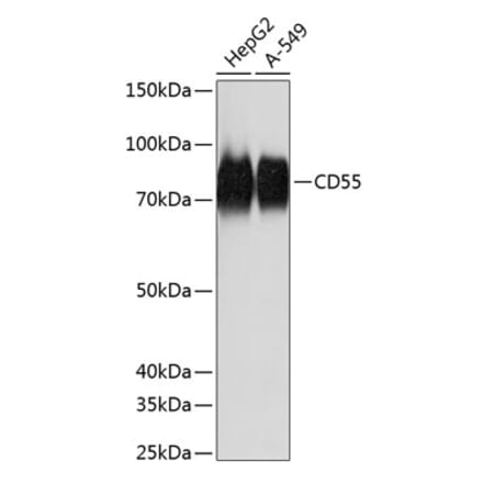 Western Blot - Anti-CD55 Antibody [ARC0568] (A305715) - Antibodies.com