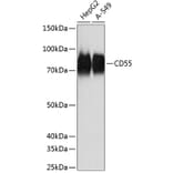 Western Blot - Anti-CD55 Antibody [ARC0568] (A305715) - Antibodies.com