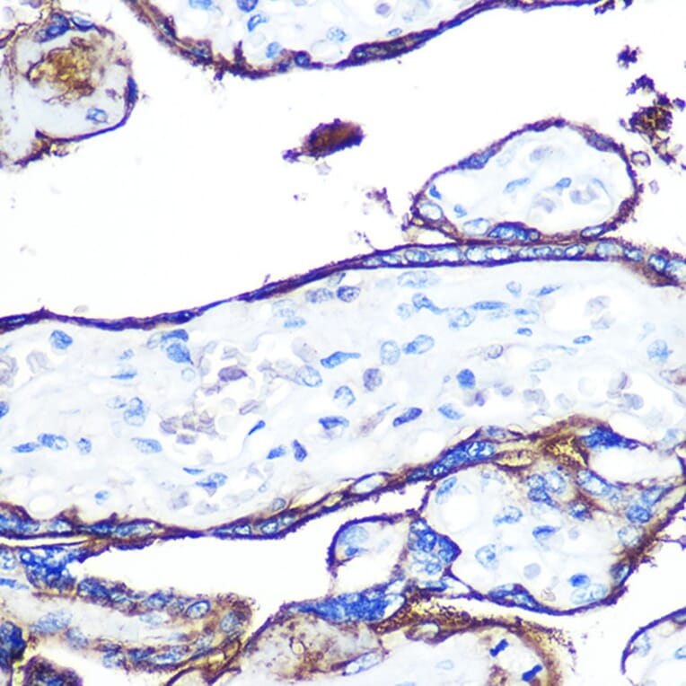 Immunohistochemistry - Anti-CD55 Antibody [ARC0568] (A305715) - Antibodies.com