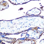 Immunohistochemistry - Anti-CD55 Antibody [ARC0568] (A305715) - Antibodies.com