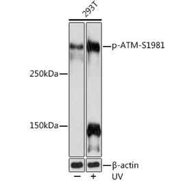 Western Blot - Anti-ATM (phospho Ser1981) Antibody [ARC1575] (A305716) - Antibodies.com