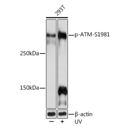 Western Blot - Anti-ATM (phospho Ser1981) Antibody [ARC1575] (A305716) - Antibodies.com
