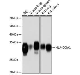 Western Blot - Anti-HLA-DQA1 Antibody [ARC0564] (A305719) - Antibodies.com