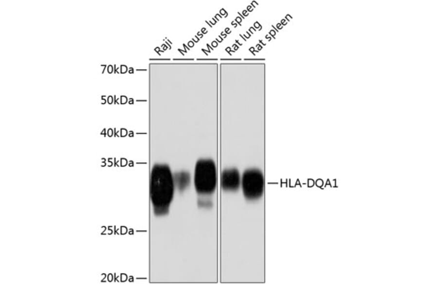 Western Blot - Anti-HLA-DQA1 Antibody [ARC0564] (A305719) - Antibodies.com