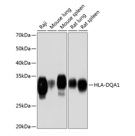 Western Blot - Anti-HLA-DQA1 Antibody [ARC0564] (A305719) - Antibodies.com