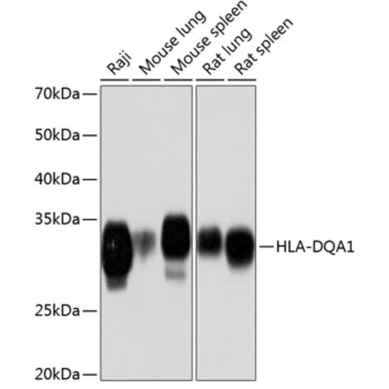 Western Blot - Anti-HLA-DQA1 Antibody [ARC0564] (A305719) - Antibodies.com