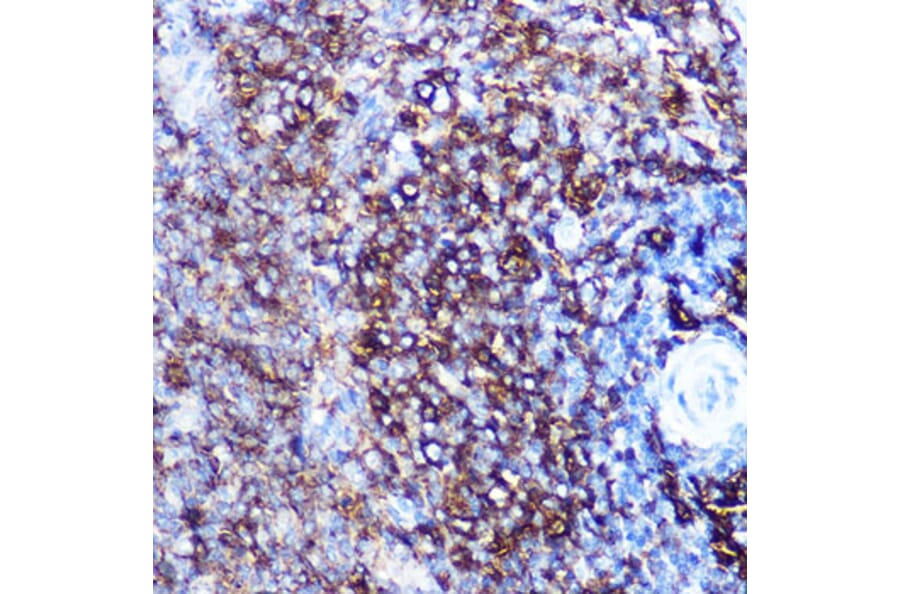 Immunohistochemistry - Anti-HLA-DQA1 Antibody [ARC0564] (A305719) - Antibodies.com