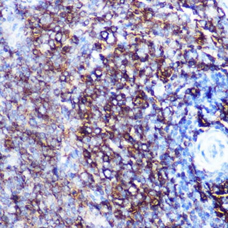 Immunohistochemistry - Anti-HLA-DQA1 Antibody [ARC0564] (A305719) - Antibodies.com