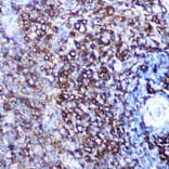 Immunohistochemistry - Anti-HLA-DQA1 Antibody [ARC0564] (A305719) - Antibodies.com