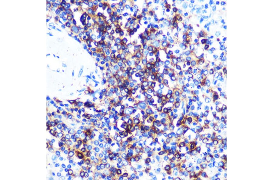 Immunohistochemistry - Anti-HLA-DQA1 Antibody [ARC0564] (A305719) - Antibodies.com