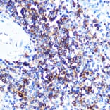 Immunohistochemistry - Anti-HLA-DQA1 Antibody [ARC0564] (A305719) - Antibodies.com