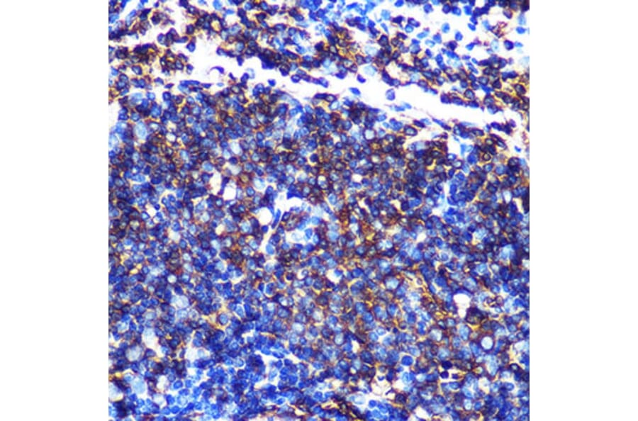 Immunohistochemistry - Anti-HLA-DQA1 Antibody [ARC0564] (A305719) - Antibodies.com