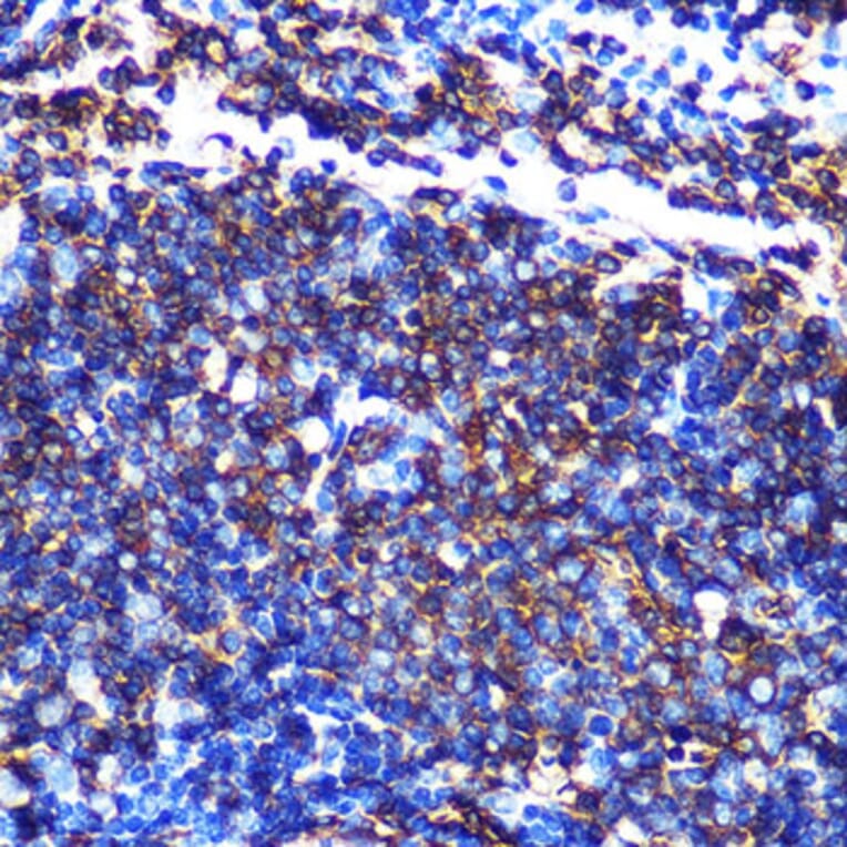Immunohistochemistry - Anti-HLA-DQA1 Antibody [ARC0564] (A305719) - Antibodies.com