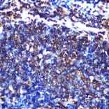 Immunohistochemistry - Anti-HLA-DQA1 Antibody [ARC0564] (A305719) - Antibodies.com