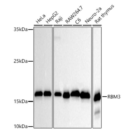 Western Blot - Anti-RBM3 Antibody [ARC2882] (A305721) - Antibodies.com