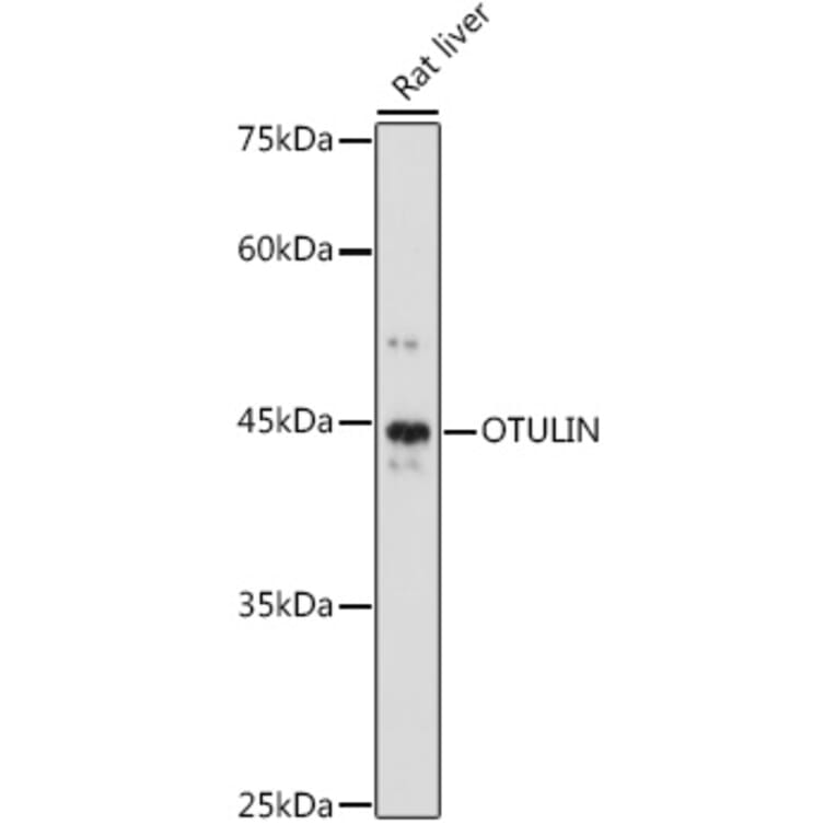 Western Blot - Anti-OTULIN Antibody (A305722) - Antibodies.com