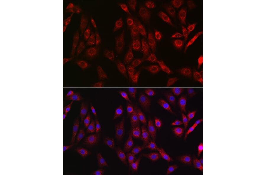 Immunofluorescence - Anti-OTULIN Antibody (A305722) - Antibodies.com