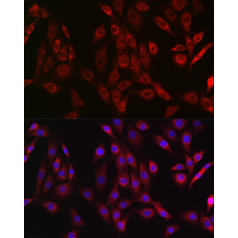 Immunofluorescence - Anti-OTULIN Antibody (A305722) - Antibodies.com