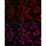 Immunofluorescence - Anti-OTULIN Antibody (A305722) - Antibodies.com