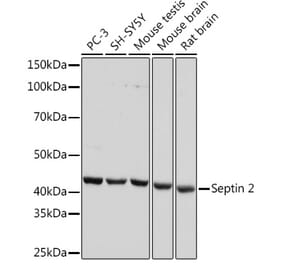 Western Blot - Anti-Septin 2 Antibody [ARC1810] (A305724) - Antibodies.com