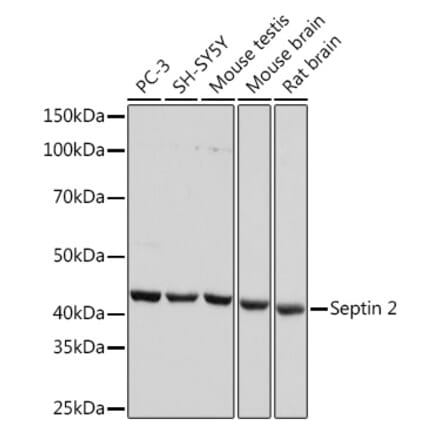 Western Blot - Anti-Septin 2 Antibody [ARC1810] (A305724) - Antibodies.com