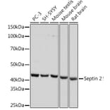 Western Blot - Anti-Septin 2 Antibody [ARC1810] (A305724) - Antibodies.com