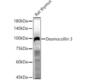Western Blot - Anti-Desmocollin 3 Antibody (A305725) - Antibodies.com